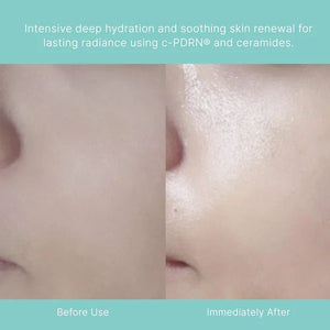 REJURAN Turnover Mask (Prev. Healing Mask) 40ml X 5ea, image 2