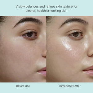 REJURAN Healer Rebalancing Toner 120ml, image 2