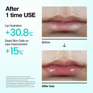 Anua PDRN Lip Serum 10ml, image 3