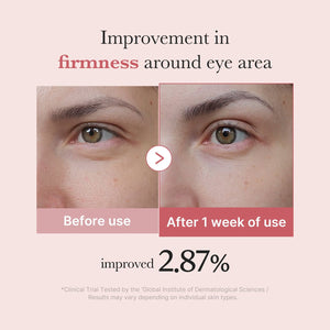 medicube PDRN Pink Peptide Eye Cream 30ml, image 4