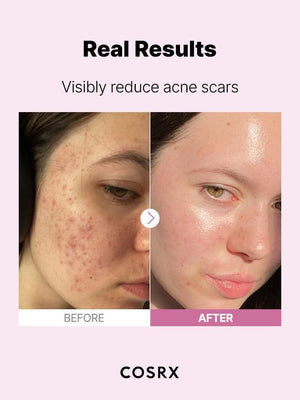 COSRX The Niacinamide 15 Serum 20ml, image 8