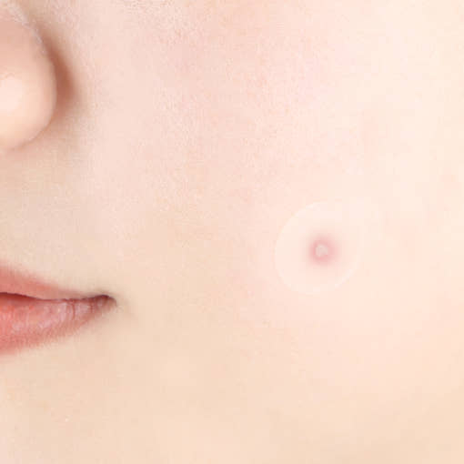 Pyunkang Yul [Pyunkang Yul] Clear Spot Patch (18ea X 4ea)