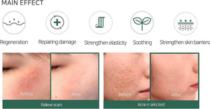 SOME BY MI AHA-BHA-PHA 30Days Miracle Cream (Moisturizer) 60g, image 10