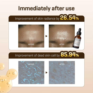 SOME BY MI Galactomyces Pure Vitamin C Glow Serum 30ml, image 10